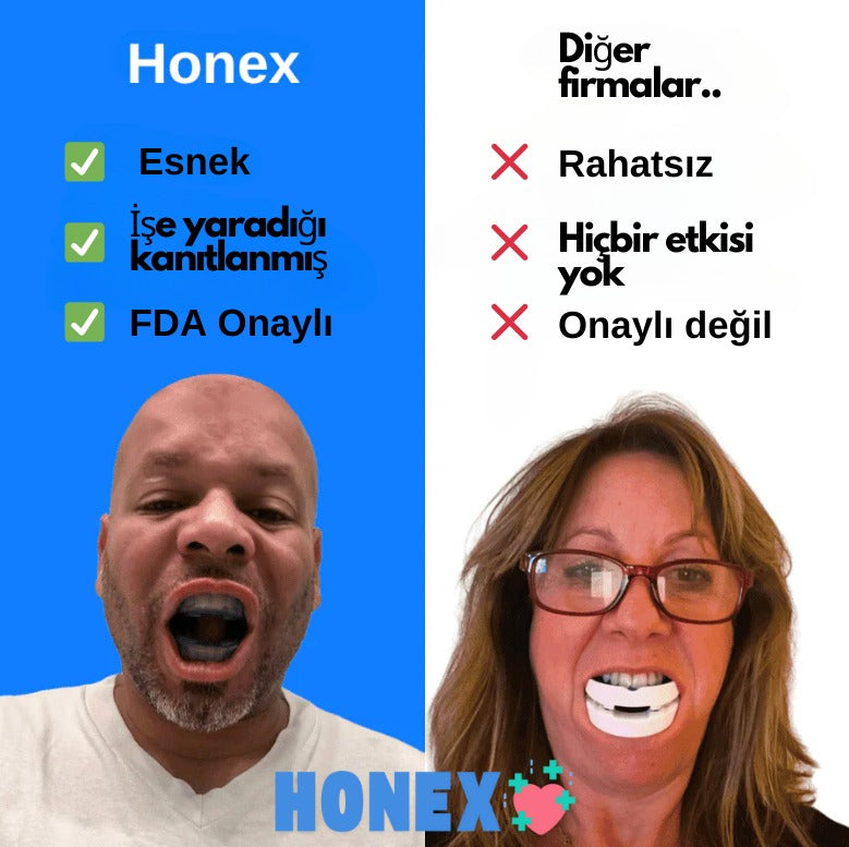 Sessiz Horlama Önleyici Ağızlık Evrensel Boyut